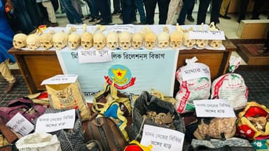 কঙ্কাল চুরির নেপথ্যে মেডিকেল শিক্ষার্থী ও সংঘবদ্ধ চক্র image